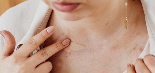 Quel remède naturel pour la cicatrisation